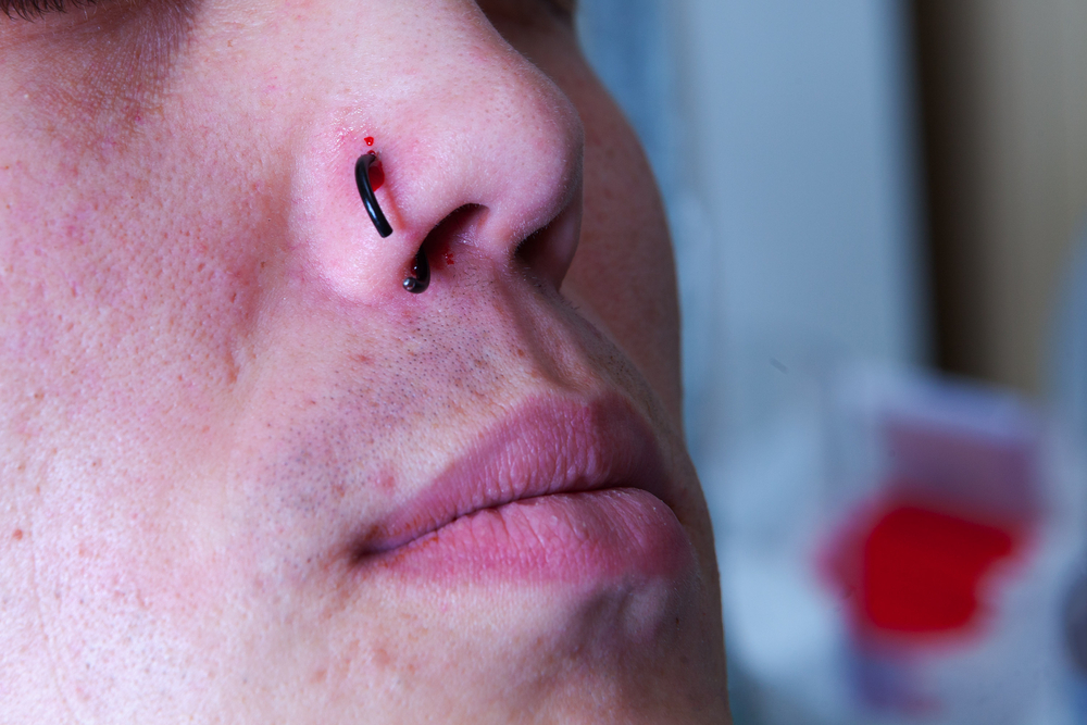 Pomada para cicatrizacao de piercing